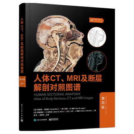 人體CTMRI及斷層解剖對照圖譜(第4版)(精) 圖書