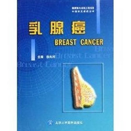乳腺癌/中國常見癌癥叢書 圖書