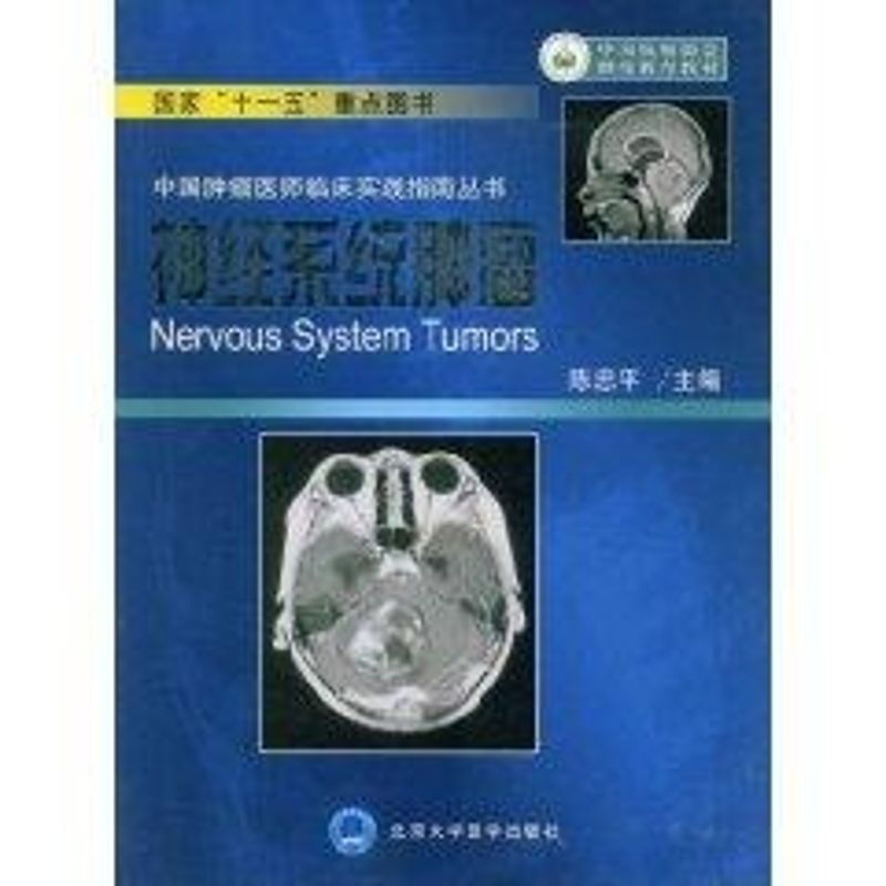 神經繫統腫瘤/中國腫瘤醫師臨床實踐指南叢書 圖書