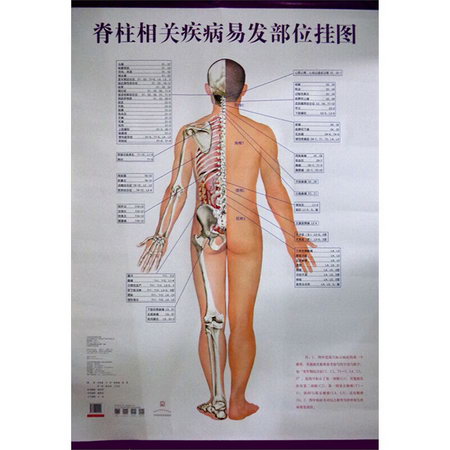 脊柱相關疾病易發部位掛圖 圖書