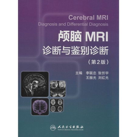 顱腦MRI診斷與鋻別診斷(第2版)