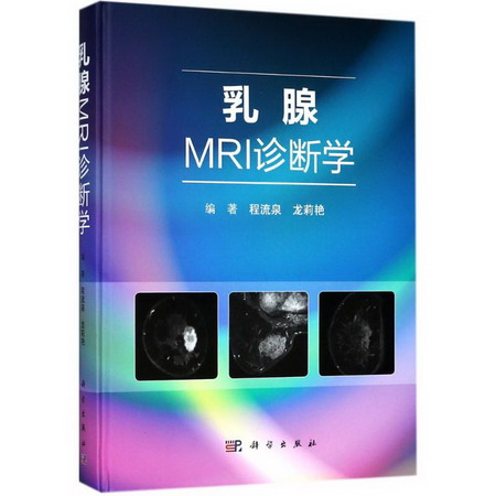 乳腺MRI診斷學