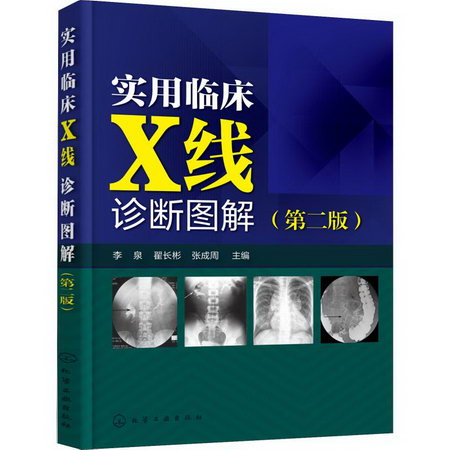 實用臨床X線診斷圖解(第2版)