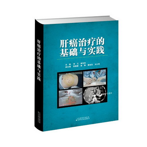 肝癌治療的基礎與實踐(精) 圖書
